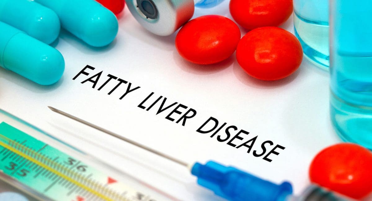 Fatty Liver Now Affects One In Three Australians | Cabot Health