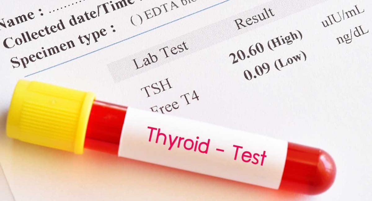 How To Read A Thyroid Blood Test | Cabot Health