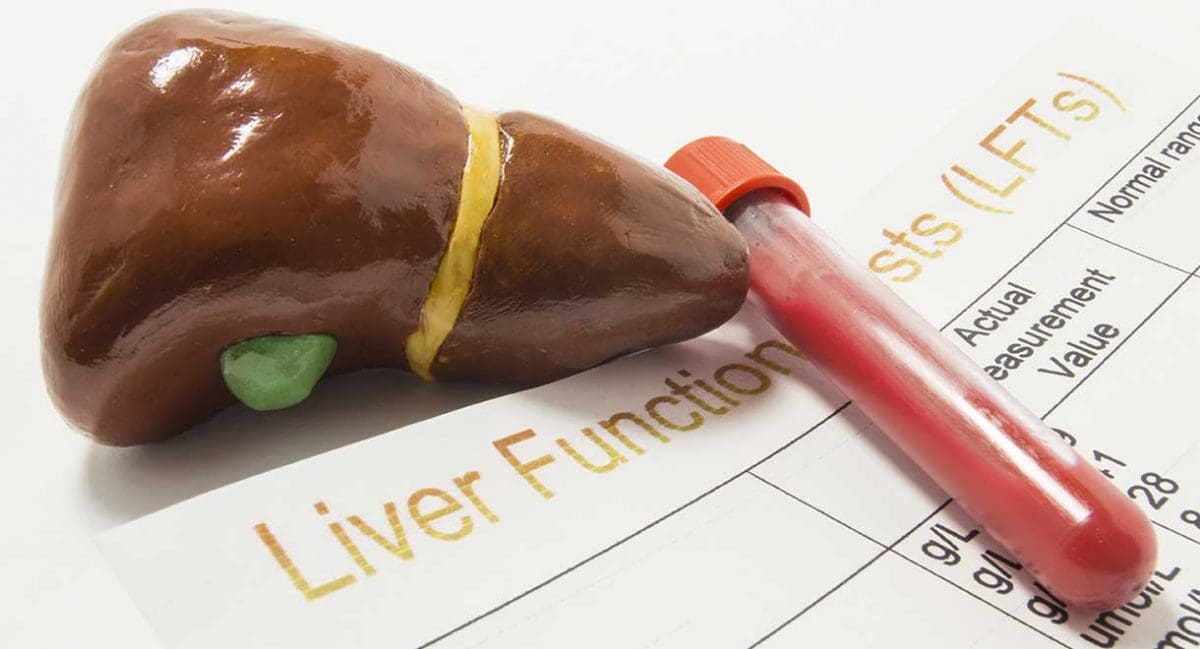 liver-blood-test-pathway-gp-portal