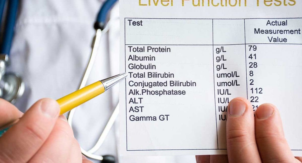 abnormal-liver-function-tests-lfts-endoscopy-plus