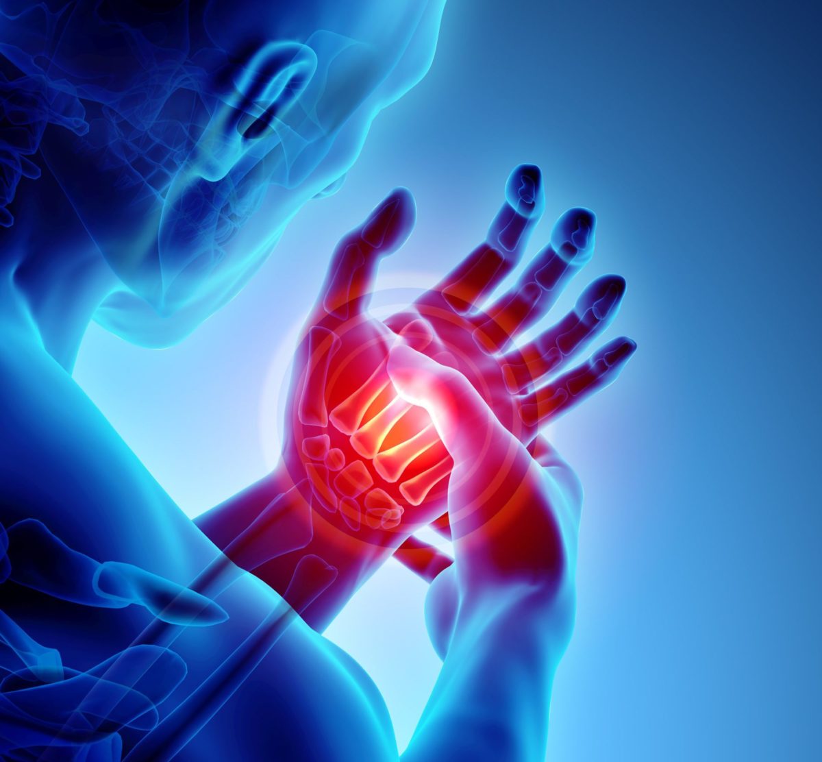 Could This Hormone Be Causing Your Arthritis? | Cabot Health